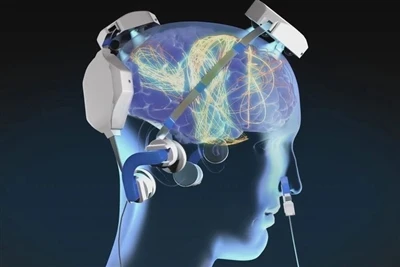 Parkinson Hastalığına Yönelik Tıbbi Cihazlarda Hangi Lazer Modülleri Kullanıl...